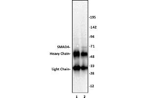 SMAD4 antibody (pAb) tested by Immunoprecipitation. (SMAD4 anticorps  (N-Term))