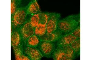 IF analysis of SAP18 using anti-SAP18 antibody (ABIN7599009) and anti-Tubulin Alpha antibody (ABIN7600339). (SAP18 anticorps  (AA 1-153))