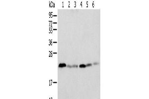 Western blot analysis of K-562 cell Human placenta tissue Mouse adrenal gland tissue HT-29 cell NIH/3T3 cell Rat lung tissue using SPCS2 Polyclonal Antibody at dilution of 1:500 (SPCS2 anticorps)