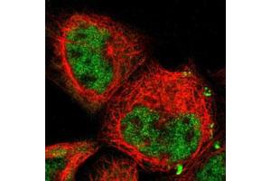 Immunofluorescent staining of A-431 cells with COPS5 polyclonal antibody  (Green) shows positivity in nucleus but excluded from the nucleoli. (COPS5 anticorps)