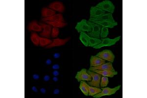 ABIN6259034 and ABIN6275060 staining Hela cells by IF/ICC. (DHODH anticorps  (Internal Region))