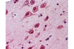 Ubiquilin 1 antibody was used for immunohistochemistry at a concentration of 4-8 ug/ml. (Ubiquilin 1 anticorps  (Middle Region))