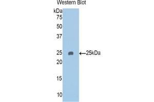 Detection of Recombinant PAPPA2, Human using Polyclonal Antibody to Pappalysin 2 (PAPPA2)