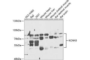 anti-Small Conductance Calcium-Activated Potassium Channel Protein 3 (KCNN3) (AA 237-426) antibody
