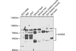 Western blot analysis of extracts of various cell lines, using KCNN3 antibody (ABIN6131839, ABIN6142768, ABIN6142770 and ABIN6218217) at 1:1000 dilution. (KCNN3 anticorps  (AA 237-426))