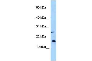 WB Suggested Anti-Nudt15 Antibody Titration: 1.