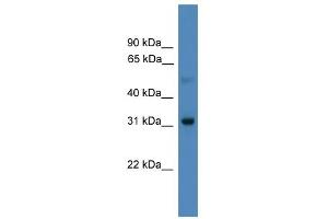 WB Suggested Anti-LBX1 Antibody Titration:  0. (Lbx1 anticorps  (N-Term))