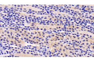 Detection of IGF1 in Human Kidney Tissue using Monoclonal Antibody to Insulin Like Growth Factor 1 (IGF1)