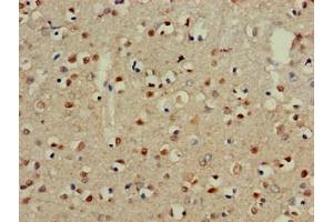 Immunohistochemistry of paraffin-embedded human brain tissue using ABIN7147247 at dilution of 1:100 (CADM3 anticorps  (AA 140-328))