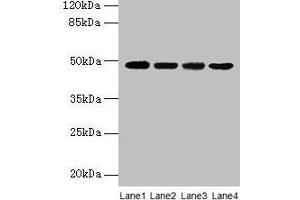 Western blot All lanes: INHBA antibody at 2 μg/mL Lane 1: Hela whole cell lysate Lane 2: HepG2 whole cell lysate Lane 3: A549 whole cell lysate Lane 4: MCF-7 whole cell lysate Secondary Goat polyclonal to rabbit IgG at 1/10000 dilution Predicted band size: 48 kDa Observed band size: 48 kDa (INHBA anticorps  (AA 311-426))