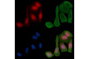 ABIN6255665 and ABIN6268972 staining Hela cells(30 min of UV treatment) by IF/ICC. (Cyclin H anticorps  (pThr315))