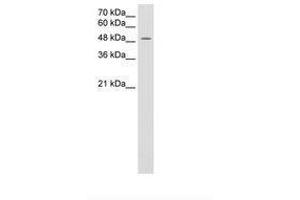 Image no. 2 for anti-Monocarboxylate Transporter 3 (MCT3) (AA 251-300) antibody (ABIN205015) (MCT3 anticorps  (AA 251-300))