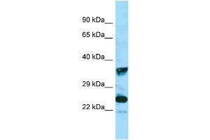 WB Suggested Anti-MRGPRX4 Antibody Titration: 1. (MRGPRX4 anticorps  (C-Term))