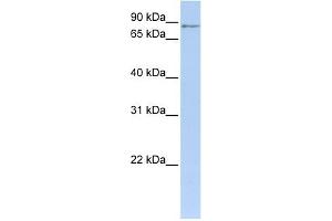 MTO1 antibody used at 1 ug/ml to detect target protein. (MTO1 anticorps)