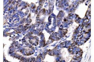 IHC analysis of p57 Kip2/CDKN1C using anti-p57 Kip2/CDKN1C antibody (ABIN7603232). (CDKN1C anticorps  (N-Term))