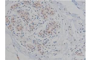 ABIN6267359 at 1/200 staining Human heart tissue sections by IHC-P.