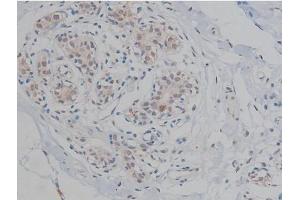 ABIN6267359 at 1/200 staining Human heart tissue sections by IHC-P. (MAPT anticorps  (pThr231))