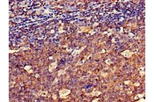 Immunohistochemistry of paraffin-embedded human tonsil tissue using ABIN7148581 at dilution of 1:100