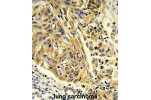 Immunohistochemistry (IHC) image for anti-Clathrin, Light Chain A (CLTA) antibody (ABIN3004002) (CLTA anticorps)