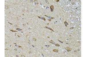 Immunohistochemistry of paraffin-embedded rat spinal cord using  Antibody (ABIN3022786, ABIN3022787, ABIN3022788 and ABIN6219229) at dilution of 1:100 (40x lens).