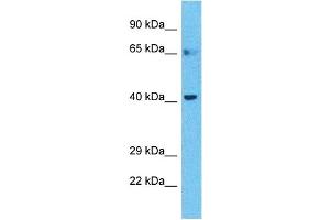 Host:  Rabbit  Target Name:  BTBD6  Sample Type:  Stomach Tumor lysates  Antibody Dilution:  1. (BTBD6 anticorps  (C-Term))