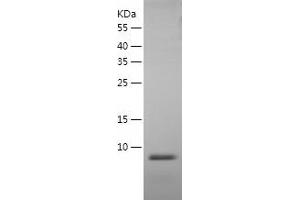 Western Blotting (WB) image for Defensin, beta 4A (DEFB4) (AA 24-64) protein (His tag) (ABIN7122621)