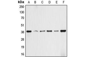 Western blot analysis of ALDOA expression in HEK293T (A), HepG2 (B), HeLa (C), NIH3T3 (D), PC12 (E), rat skeletal muscle (F) whole cell lysates. (ALDOA anticorps  (N-Term))