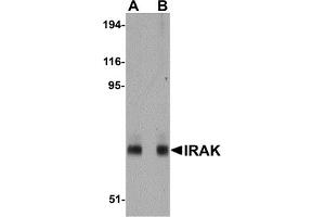 Western Blotting (WB) image for anti-Interleukin-1 Receptor-Associated Kinase 1 (IRAK1) (AA 618-712) antibody (ABIN492548) (IRAK1 anticorps  (AA 618-712))