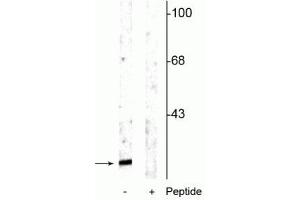Western blot of rat cortical lysate showing specific immunolabeling of the ~15 kDa alpha synuclein protein phosphorylated at Ser129 in the first lane (-). (SNCA anticorps  (pSer129))