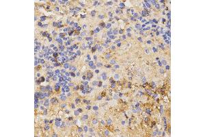 Immunohistochemistry of paraffin-embedded mouse liver fibrosis tissue using CSF2RA antibody at dilution of 1:200 (x400 lens)
