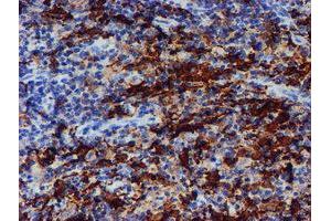 Image no. 4 for anti-Arachidonate 15-Lipoxygenase (ALOX15) antibody (ABIN1496358) (ALOX15 anticorps)