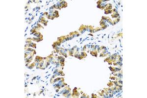 Immunohistochemistry of paraffin-embedded mouse lung using SERPINA10 antibody (ABIN5974273) at dilution of 1/100 (40x lens). (SERPINA10 anticorps)
