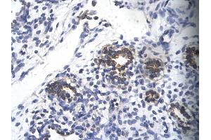 Rabbit Anti-RPS16 Antibody       Paraffin Embedded Tissue:  Human alveolar cell   Cellular Data:  Epithelial cells of renal tubule  Antibody Concentration:   4.