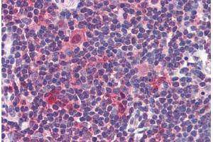 Human Thymus: Formalin-Fixed, Paraffin-Embedded (FFPE) (Caspase 7 anticorps  (C-Term))