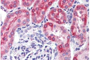 Mouse kidney: Formalin-Fixed, Paraffin-Embedded (FFPE) (IFIH1 anticorps  (C-Term))