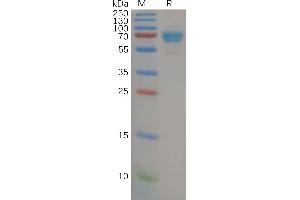 Human IL21R Protein, mFc Tag on SDS-PAGE under reducing condition