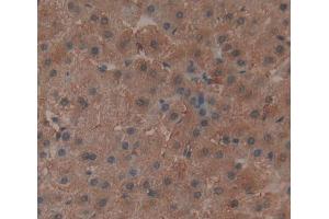 Used in DAB staining on fromalin fixed paraffin- embedded Kidney tissue