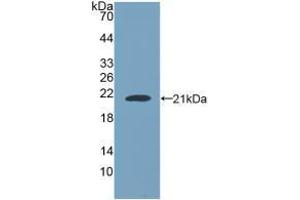 Western blot analysis of recombinant Human NUP210. (NUP210 anticorps  (AA 1288-1449))