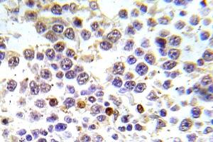 Immunohistochemistry (IHC) analyzes of p-Histone H3. (Histone H3.1 anticorps  (pSer10))