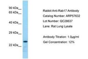 Image no. 1 for anti-RAB17, Member RAS Oncogene Family (RAB17) (AA 121-170) antibody (ABIN6749942) (RAB17 anticorps  (AA 121-170))