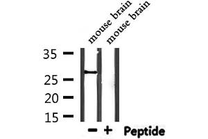 Western blot analysis of extracts from mouse brain, using PSMA1 Antibody.
