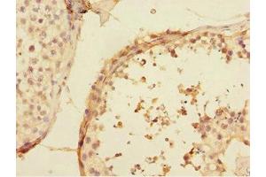 Immunohistochemistry of paraffin-embedded human testis tissue using ABIN7174506 at dilution of 1:100 (UBE2Z anticorps  (AA 115-354))