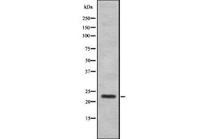 Western blot analysis SAP30 using 293 whole cell lysates (SAP30 anticorps  (Internal Region))