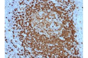 Formalin-fixed, paraffin-embedded human Lymph Node stained with TCL1 Mouse Monoclonal Antibody (TCL1/2079).