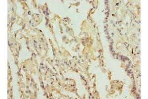 Immunohistochemistry of paraffin-embedded human lung tissue using ABIN7158277 at dilution of 1:100 (LILRB4 anticorps  (AA 22-259))
