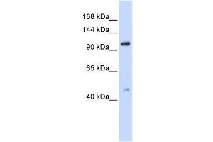 TRPC4 antibody used at 1 ug/ml to detect target protein. (TRPC4 anticorps  (Middle Region))