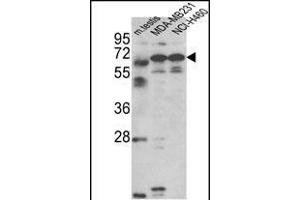 Western blot analysis of Fascin-3 Antibody (N-term) (ABIN390722 and ABIN2840998) in MDA-M, NCI- cell line and mouse testis tissue lysates (35 μg/lane). (Fascin 3 anticorps  (N-Term))