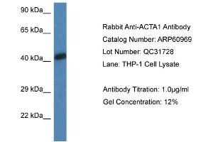 Western Blotting (WB) image for anti-Actin, alpha 1, Skeletal Muscle (ACTA1) (N-Term) antibody (ABIN2788636) (Actin anticorps  (N-Term))