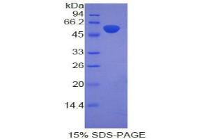 SDS-PAGE analysis of Rat Adrenocorticotropic Hormone Protein. (POMC Protéine)