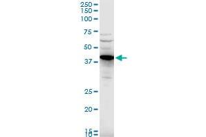 CADM1 polyclonal antibody (A01), Lot # UOZ1060607QCS1. (CADM1 anticorps  (AA 151-250))